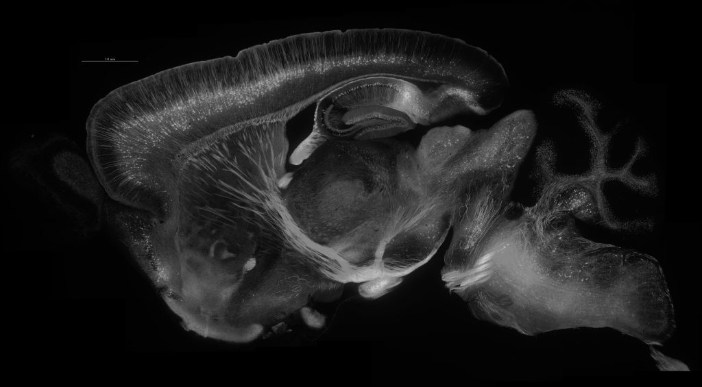 研究で観察するマウスの脳の断面（左が鼻側で、右が尾側）。遺伝子の改変により神経細胞に標識がついているため、広く光って見える。このマウスを使って、脳の回路構造の変化などを観察できる